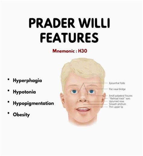 prada willis|prader willi disease nhs.